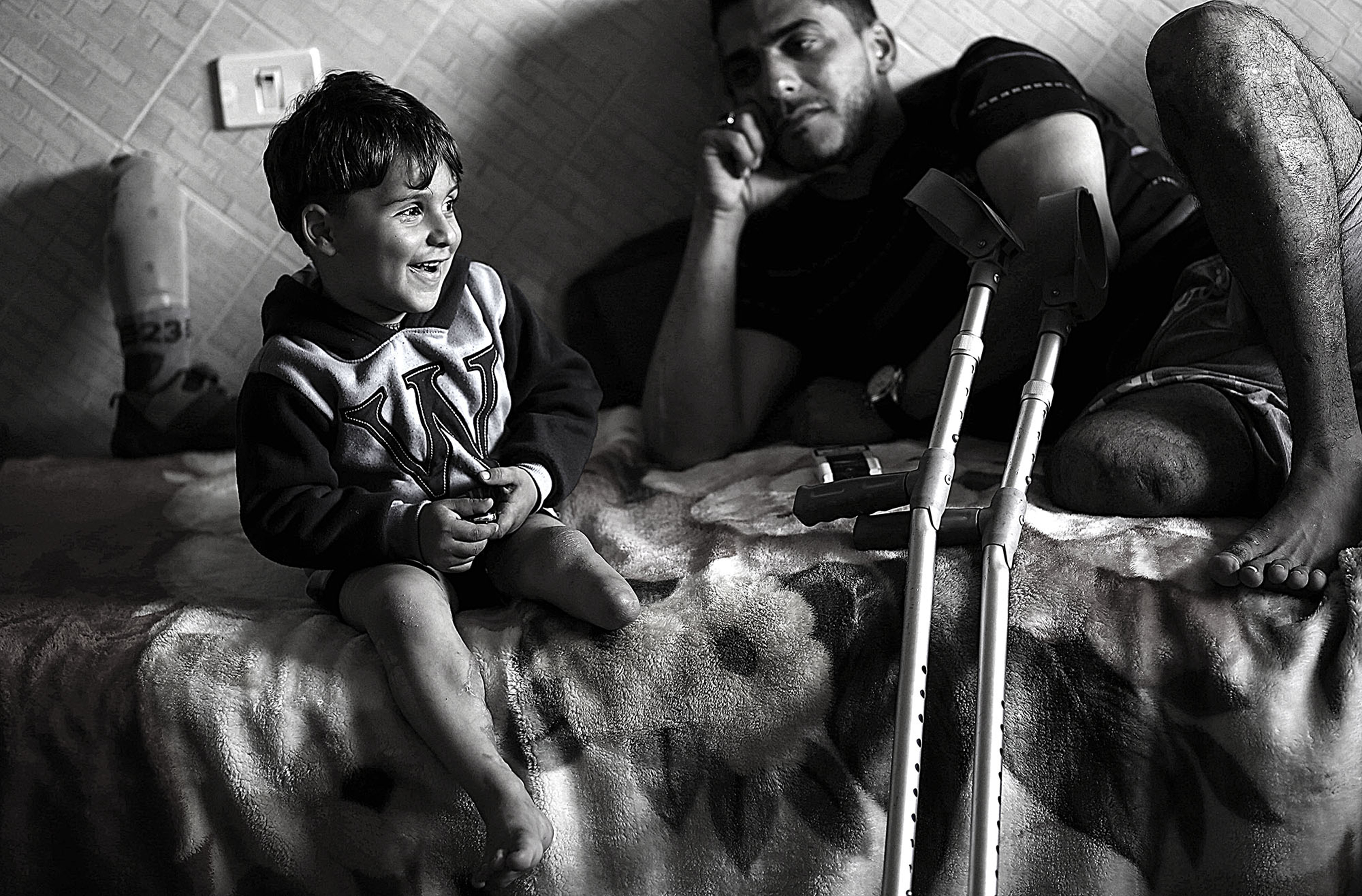 Wael Al-Namla, 27, sits with his son three years old Shareif In their house in Al- Joneina neighbourhood in the east of Rafah town in the southern Gaza Strip on 17 March 2015. Wael Al Namla, 27, his wife Israa, 21, and their son Shareif three years old, three of them lost the lower lips together to one Israeli bomb when they were trying to find a safe place to stay at, following a 72-hour ceasefire declaration during the 51 day of war in, 01 Augast 2014.